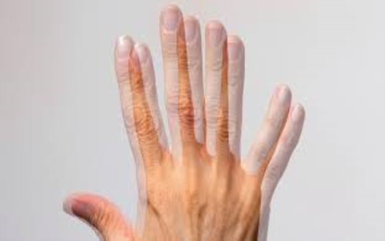 Navigating Double Vision: Understanding Causes and Solutions for Monocular Diplopia